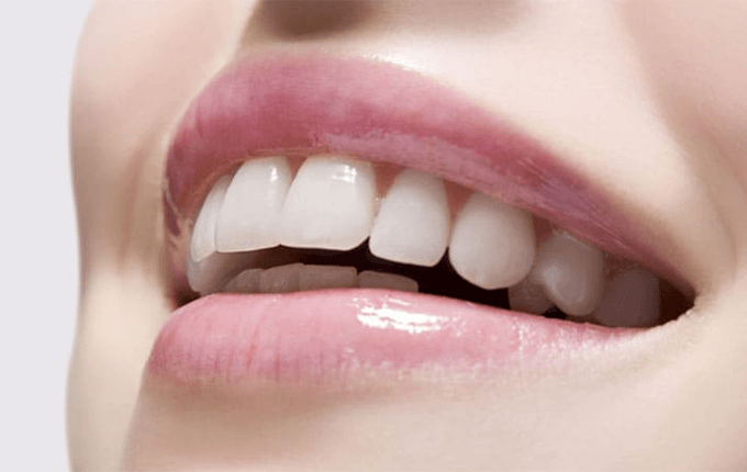  عوارض لمینت دندان 