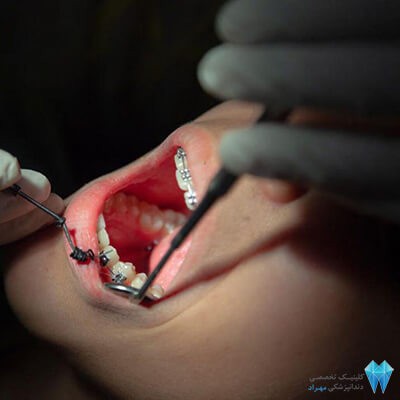 دندانپزشکی خوب در غرب تهران