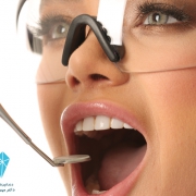 جراحی دندان عقل در تهران