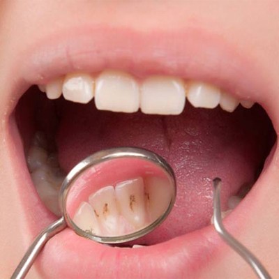 بهترین کلینیک دندانپزشکی تهرانبهترین کلینیک دندانپزشکی تهران