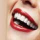 التهاب بعد از کامپوزیت دندان