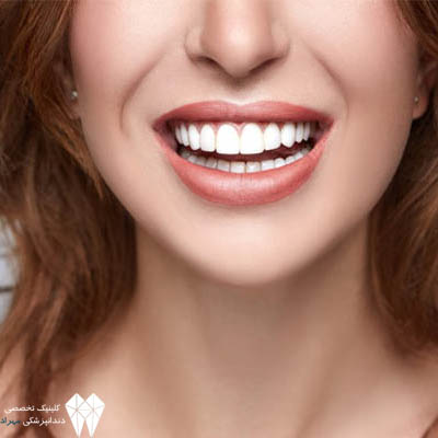 انواع کامپوزیت دندان بر اساس سایز
