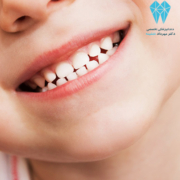 عوامل موثر در قرار گرفتن دندانها