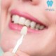 پاسخ به سوالات راجع به درمان لمینت دندان