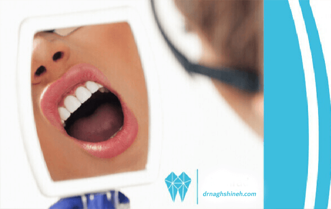 بهترین دندانپزشکی در تهران چه ویژگی هایی دارد؟