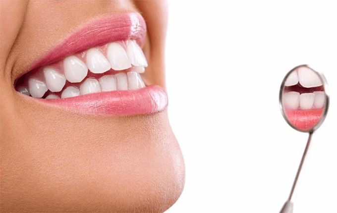 آیا لمینیت دندان برای دندان های پوسیده امکان پذیر است؟