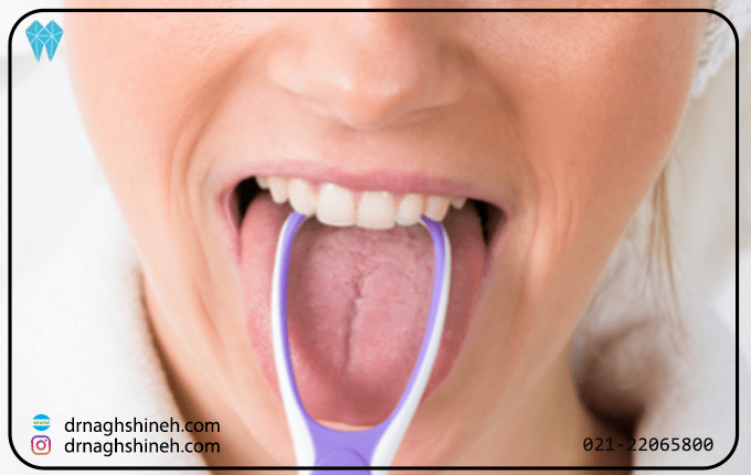   15 روش درمان خانگی بوی بد دهان