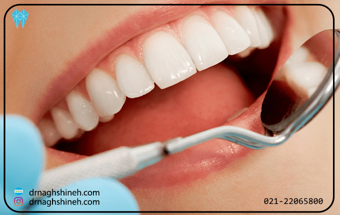 انواع تاج دندان